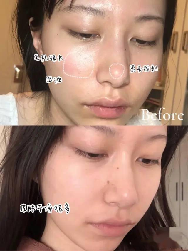 沈梦辰这脸变的!《乘风破浪》这皮肤状态,估计花了不少钱吧?