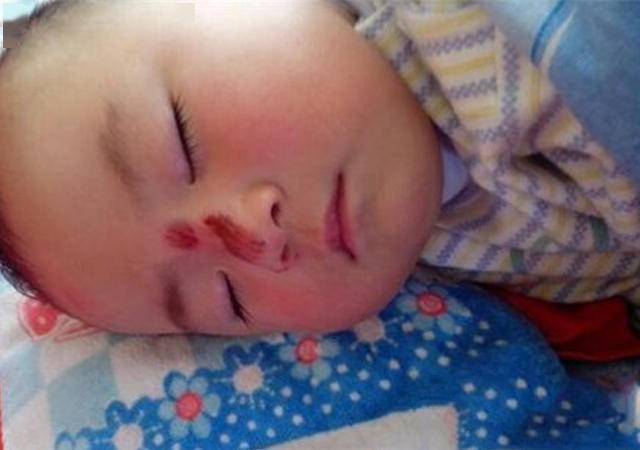 小时|10秒钟完成“三看”,48小时密切关注,一步都错不起宝宝坠床后