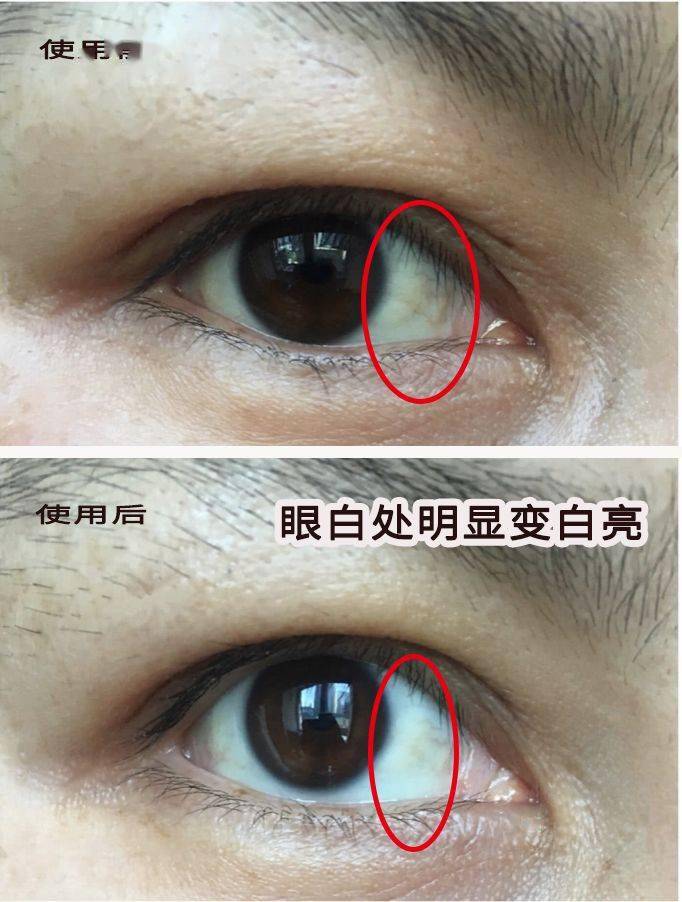 一片=10贴眼膜！解救“疲劳眼”！25分钟蒸走干黑眼圈，还你少女明眸