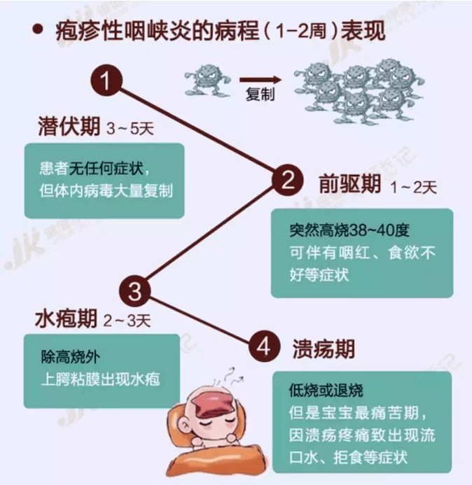 伊顿后勤健康指导之如何预防疱疹性咽颊炎