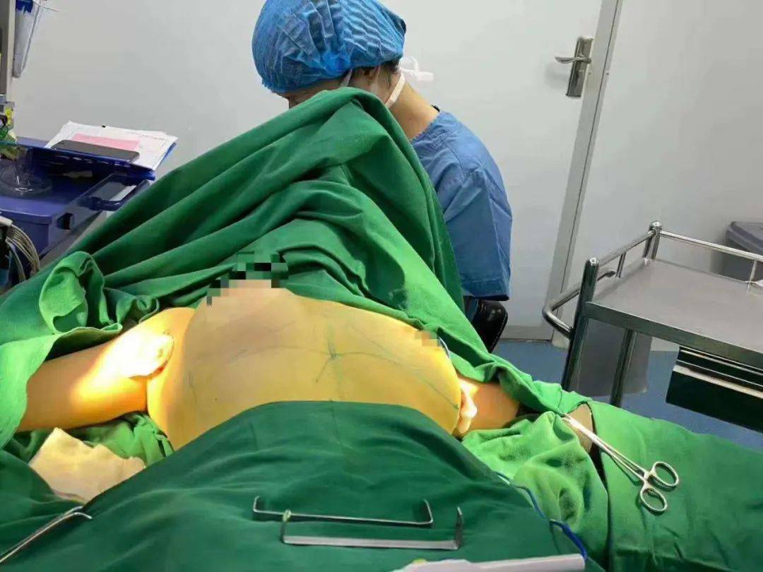 宁夏女子做缩胸手术后陷入"噩梦",记者暗访整形诊所