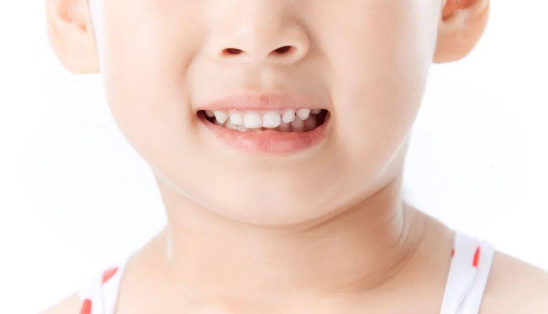 没有间隙 说明儿童颌骨生长发育存在不足 反而需要早期矫治干预 牙齿