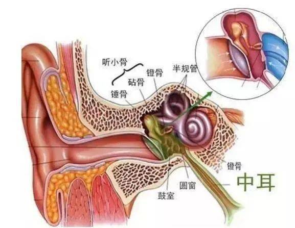 中耳炎出血怎么办