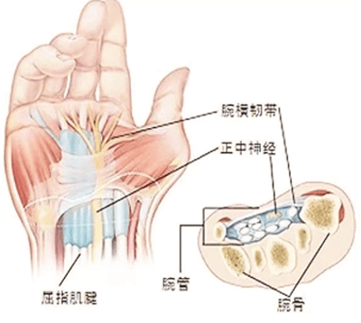 上臂骨折怎么办