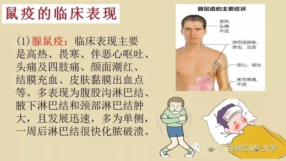 【健康科普】认识鼠疫了解鼠疫