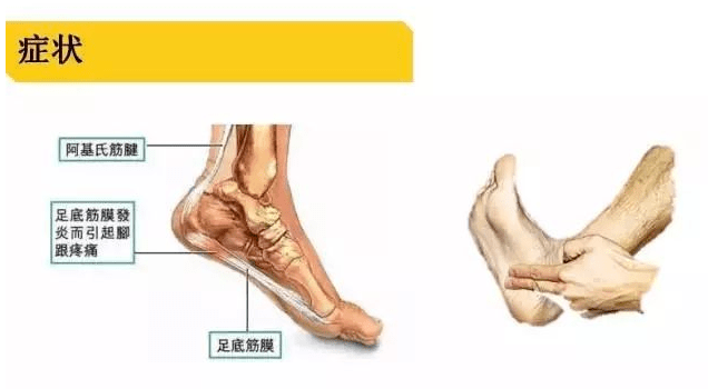 足跟内外两侧的筋是以脚踝为圆心向后,向下,成面状分布的.