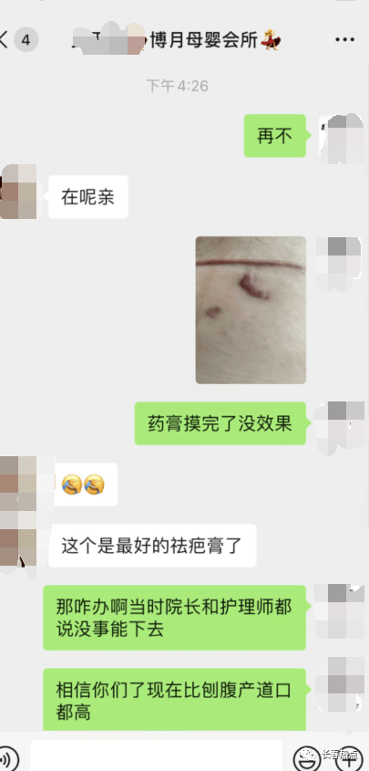 坐月子手被烫了怎么办