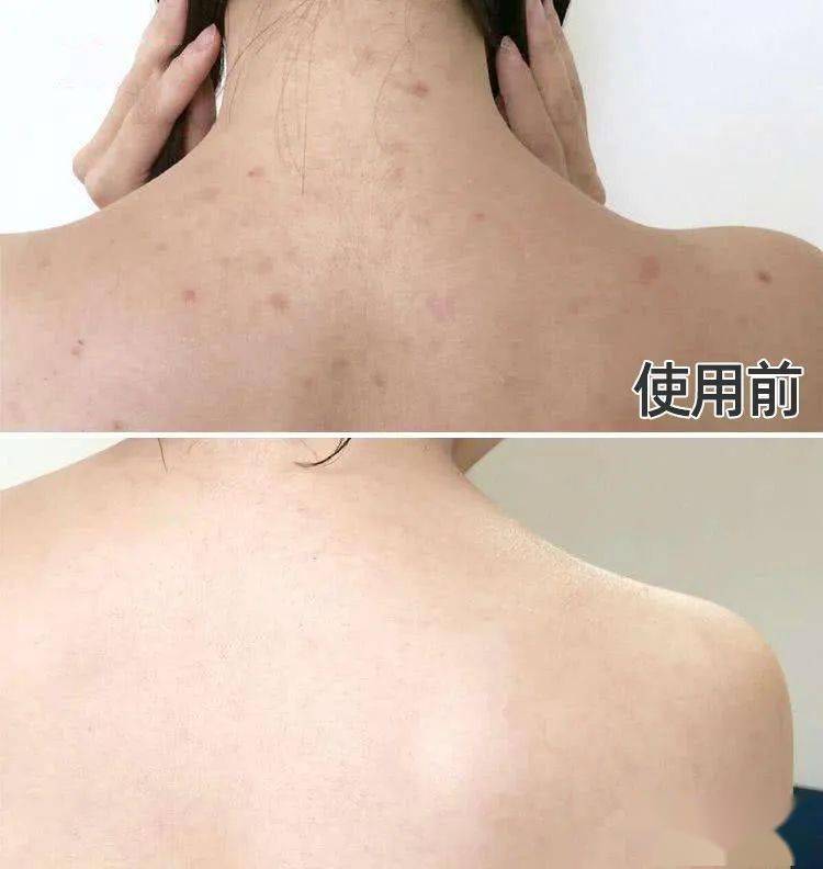 全身|洗澡时多搓搓这2处，疏通全身，更显年轻，体味淡多了