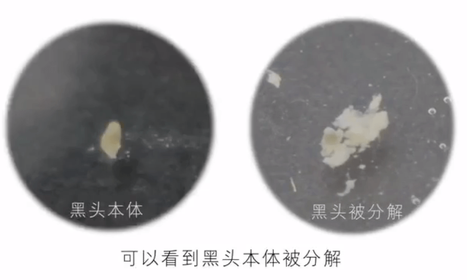 毛孔|原来想要拥有干净、清透的“初恋素颜脸”，只需要做好这一步！