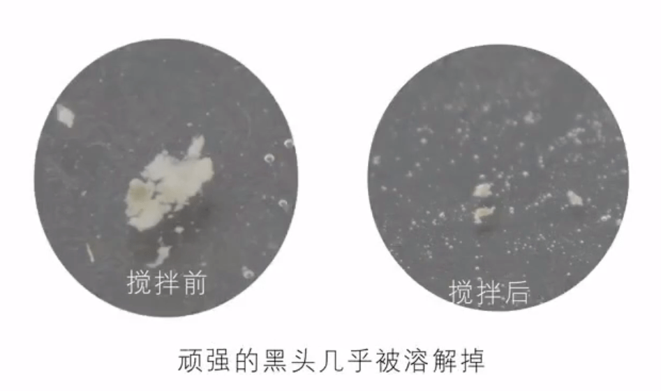 毛孔|原来想要拥有干净、清透的“初恋素颜脸”，只需要做好这一步！