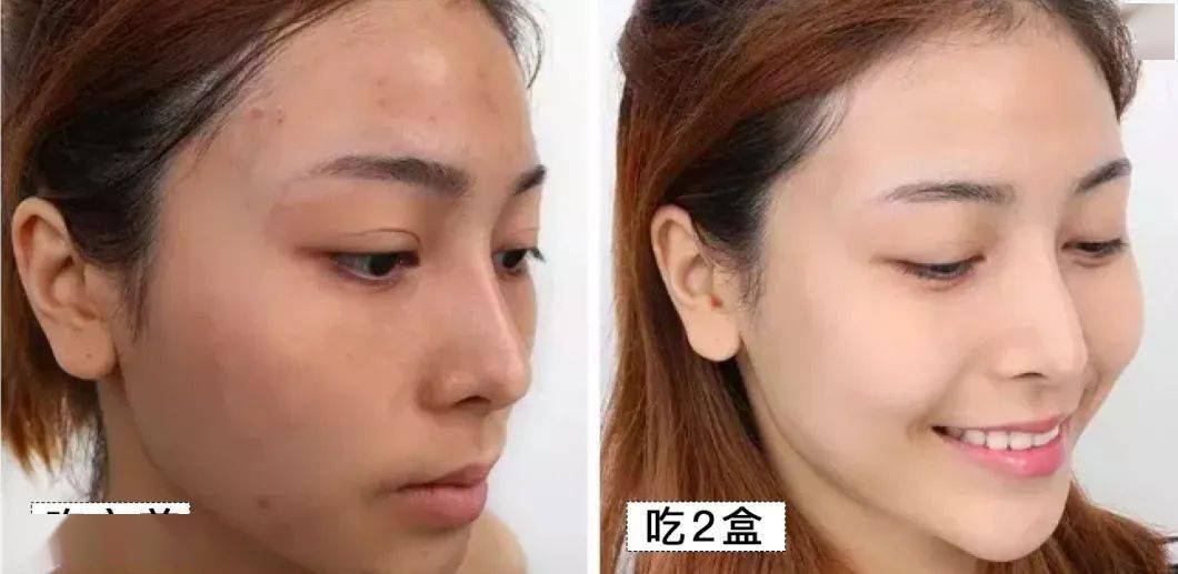 大妈|2个月狂甩56斤！160斤韩国大妈变全民女神！秘诀竟然是吃它？