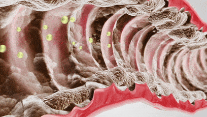 大妈|2个月狂甩56斤！160斤韩国大妈变全民女神！秘诀竟然是吃它？