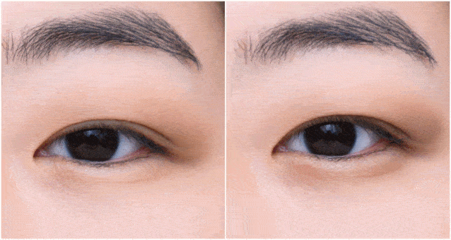 眼睛|张雨绮为啥越看越可爱，这一点真的很重要