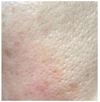 角质|能搓出“脏东西”的它3秒卖出一瓶！去角质、黑头、收毛孔，给你肌肤来次“大扫除”!