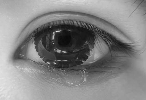 没有做好眼部卫生导致炎症发生,如结膜炎,会导致眼部流泪现象增多