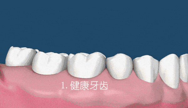 牙粉|爱笑的女人真美