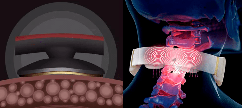 call|众明星打call～！能折叠放进口袋的按摩仪，随时拯救颈椎不适，真舒服！
