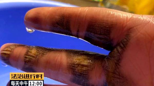 电动车|女子骑“共享电动车”被电伤，索赔遭遇阻力