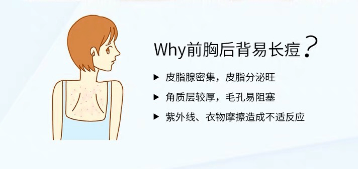 夏天|精致女孩就是要照顾到夏天露出的每一寸肌肤!