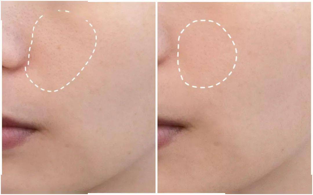 面膜|推广||她们说：这5件好物值得无限回购！