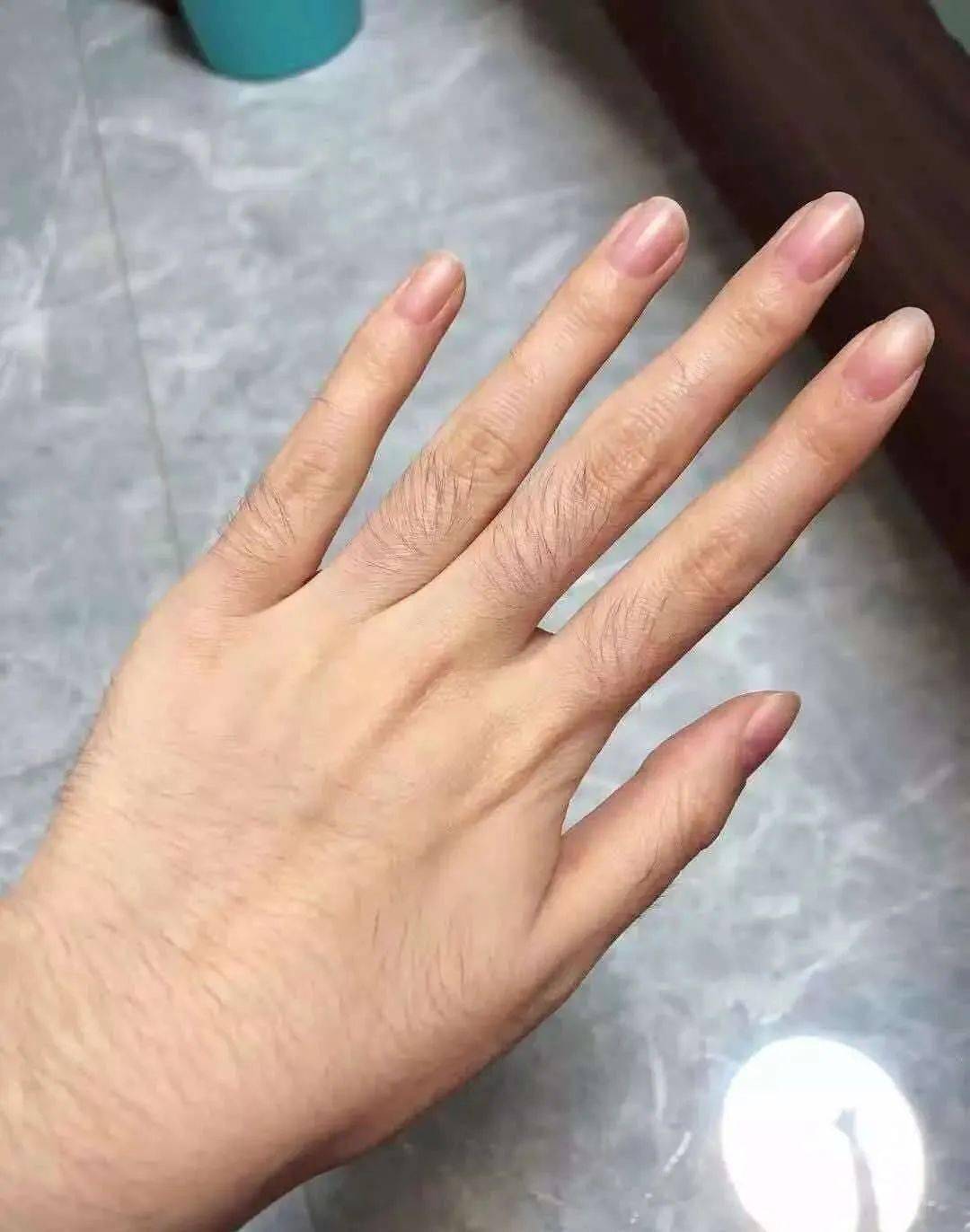 广东这家店99元永久脱毛!错过就亏大了!