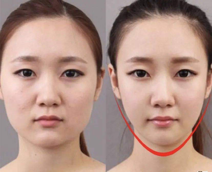 效果|这个比瘦脸针还好用的好物，既消水肿又提拉紧致，立变小V脸！