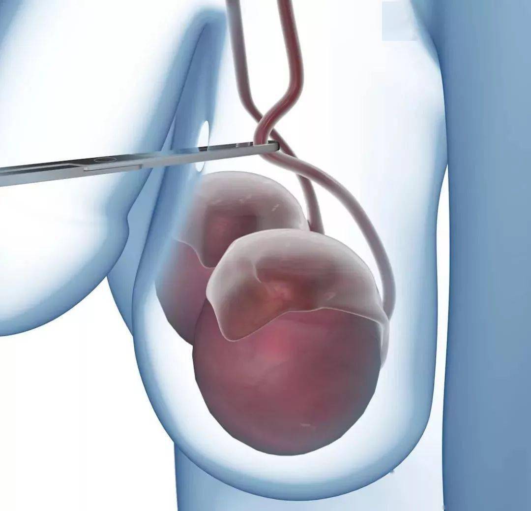 男性|再见了，避孕套！男性避孕针终于来了...佛山女生：爱我就打针！