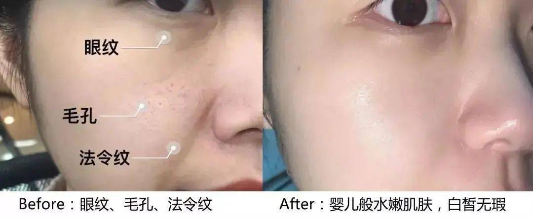 肌肤|睡前涂这个，顶10片面膜，日本爆火睡眠面膜，一夜回春不是梦