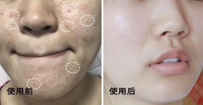 张天|张天爱比杨幂会“撩”?让小奶狗痴迷的她,到底有啥不一样?