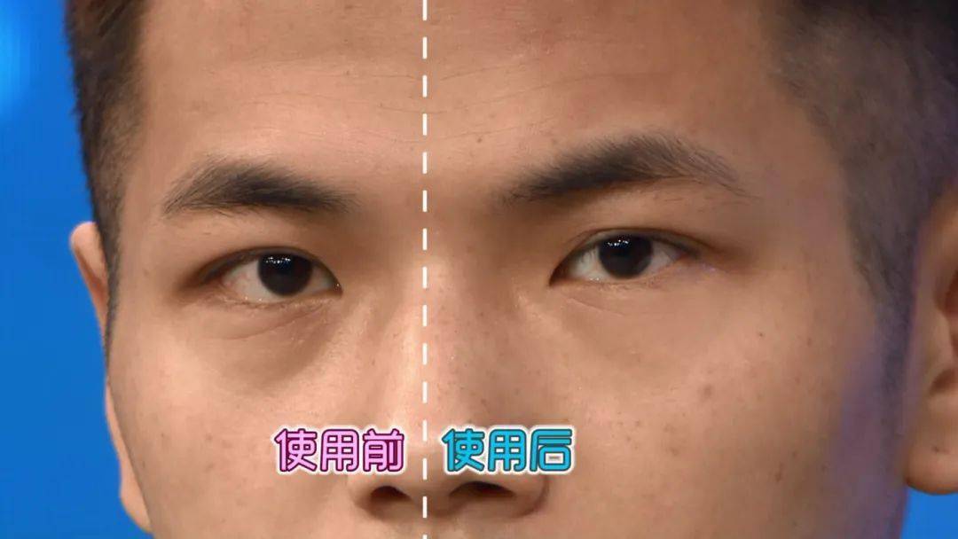 效果|震撼黑科技！搞定眼袋、细纹、浮肿、黑眼圈……效果比PS还好！