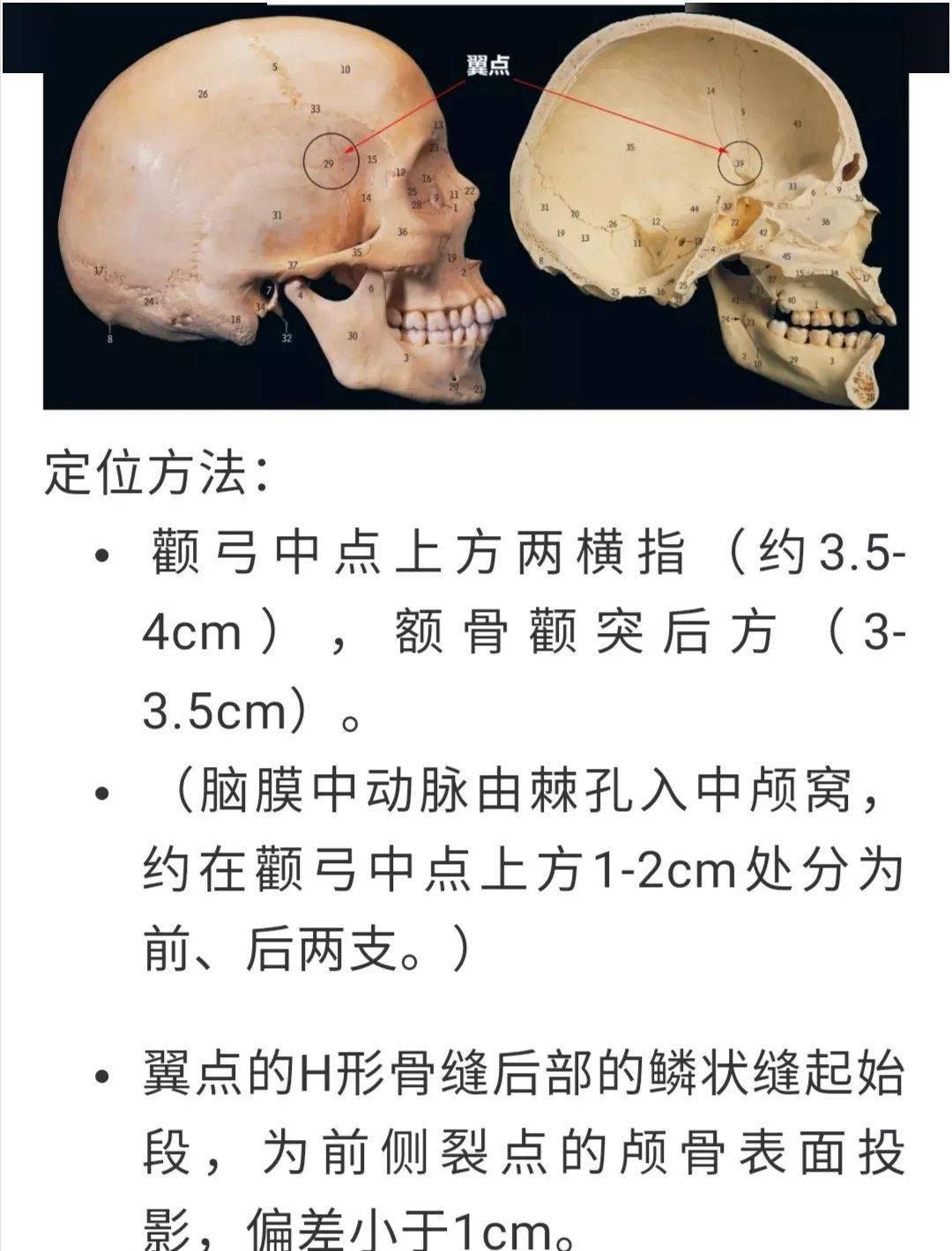 颞线 :由额骨颧突外缘向上后至冠状缝的弧形线,上,下颞线并行,其末端