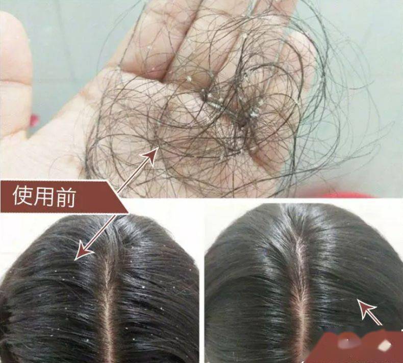 头发|堪称史上最快的懒人法宝，8秒干枯的发质立马变身柔顺、飘逸、有弹性的“绸缎发”？！