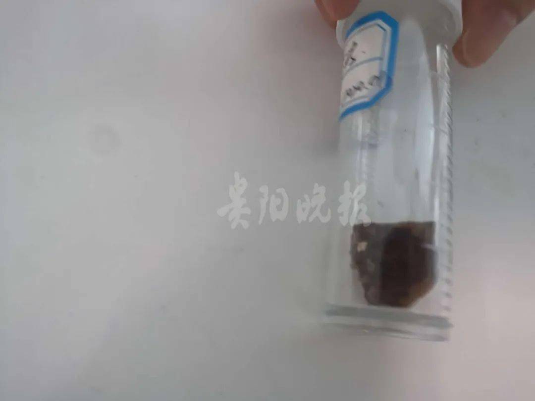 硬币|医生都无语！孩子竟吞下这些怪东西！硬币、指甲刀、电池、钉子……