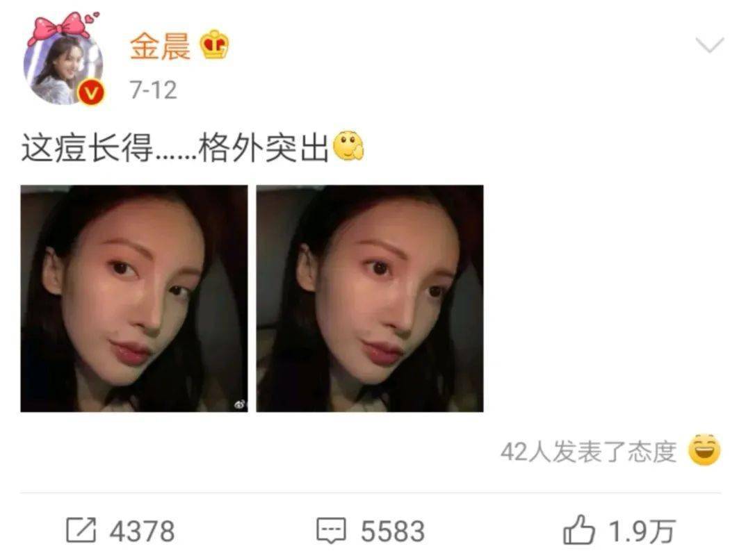 决战|好好养护依然生生不息!名医教你决战“顽固的青春痘”