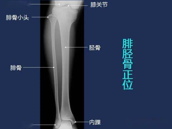 影像解剖 | 全身常规x线,骨关节mri断层解剖大全