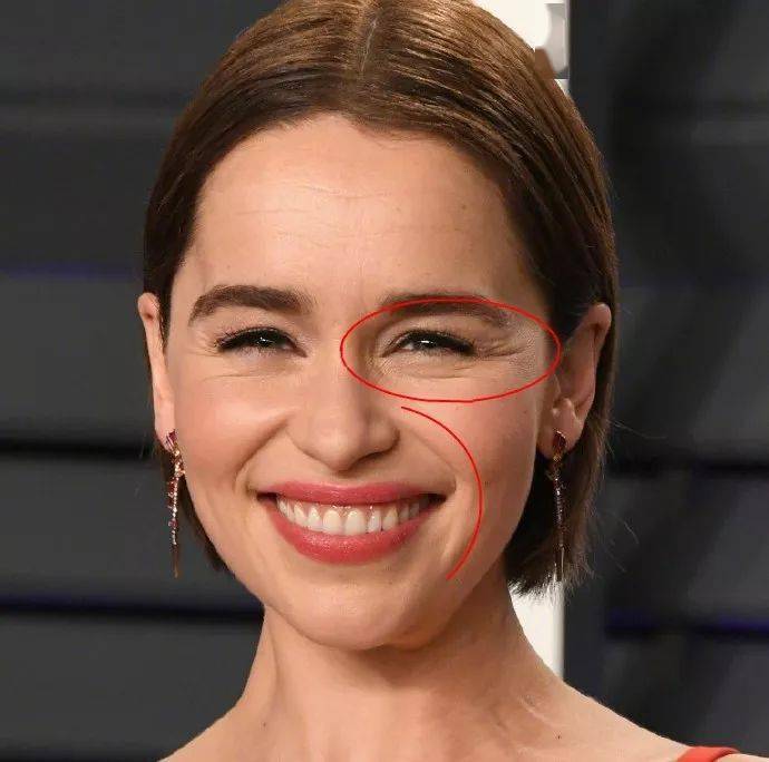 皱纹|抗皱抗衰老还在打针?用它赶走三八脸、鱼尾纹,让小朋友见到你都喊姐姐!