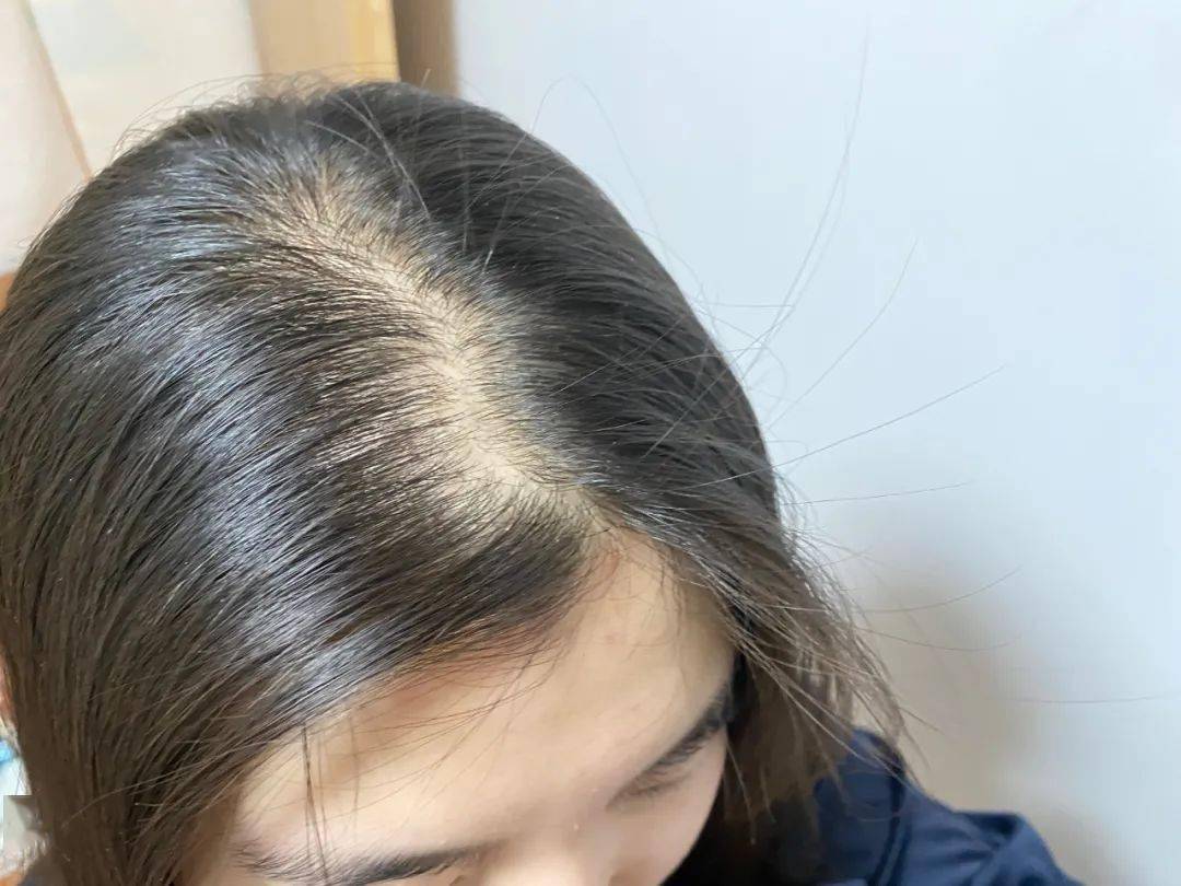 脱妆就上热搜?其实他这里也“脱”了 脱妆就上热搜?其实他这里也“脱”了