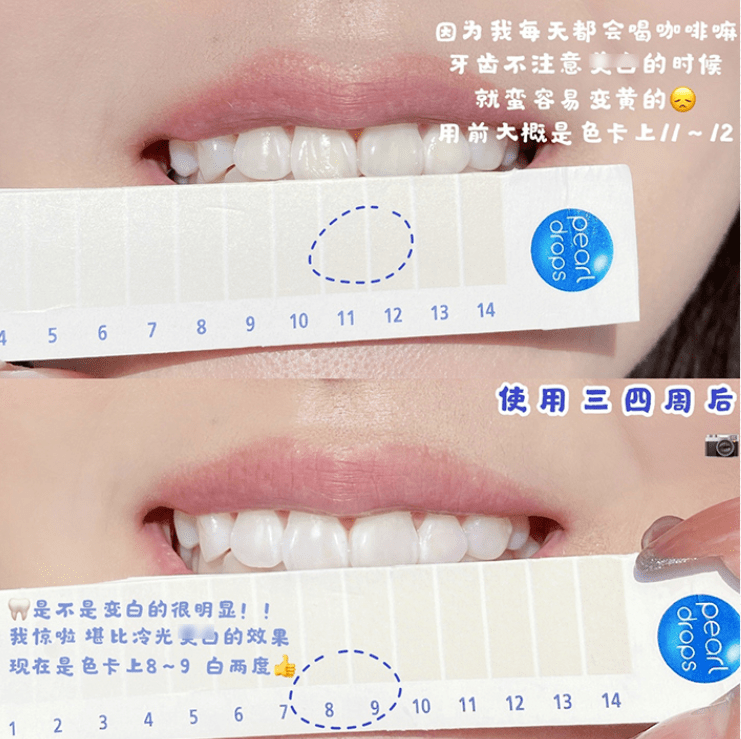 牙膏|牙黄真的太毁颜值！连涂口红都没人家好看