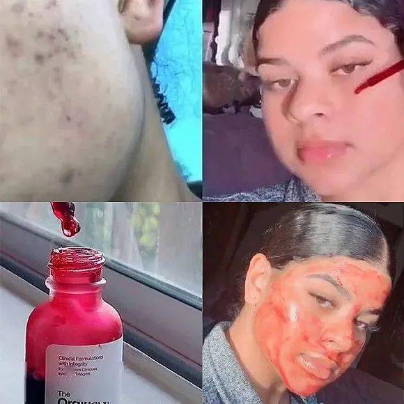 TikTok|TikTok的命运将如何影响国货美妆的出海战略？