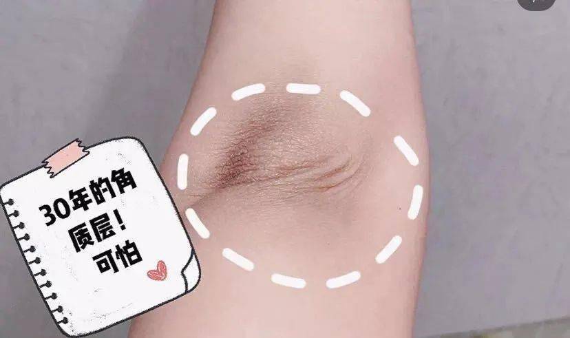 不知道|用1颗糖洗澡是什么体验？不洗都不知道身上这么脏，竟然还能扣出油脂粒！