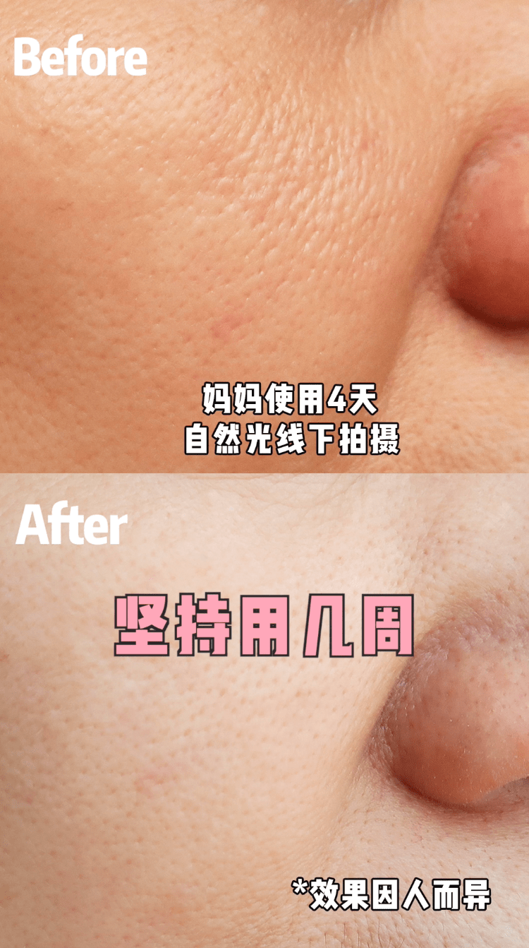 直播间|1件顶100件，此生不能没有它！