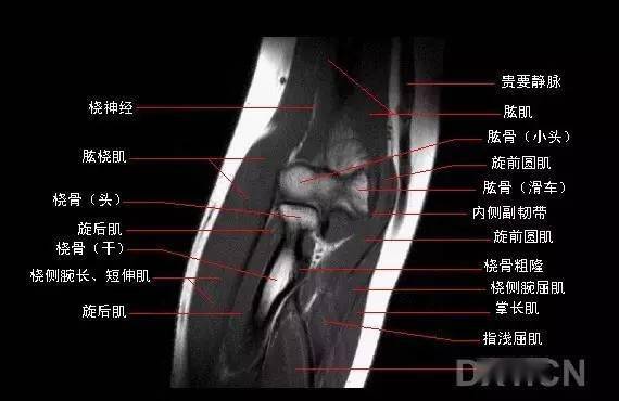 影像解剖 | 肘关节mri图谱,超全整理!