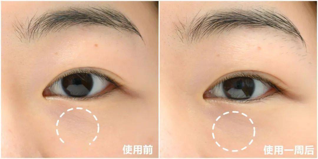 皮肤|推广|| 一生推的品牌又出新品了，预定下一个爆款！