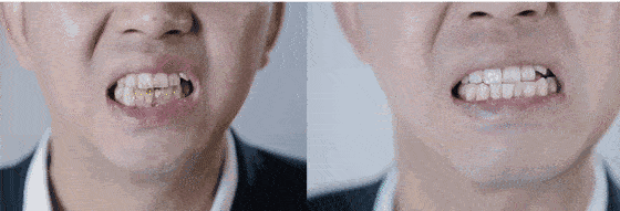 口腔|重度口臭者不刷牙，却依然口气清新？他只做了一件事...