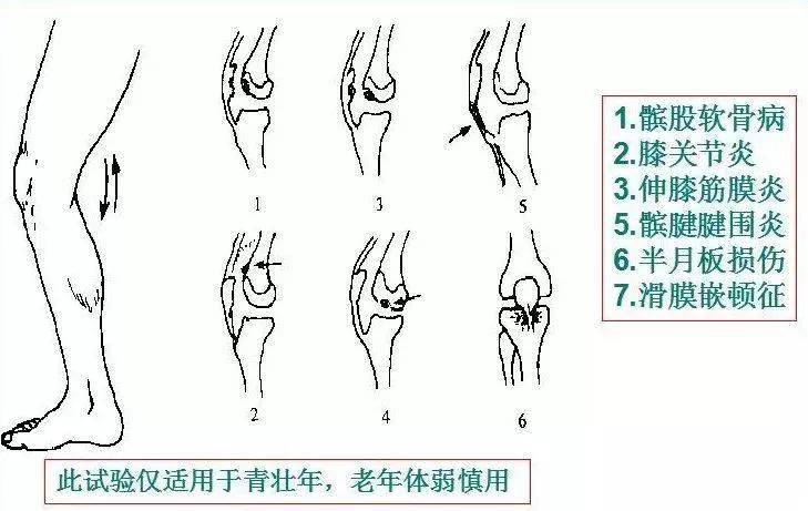 4.单足半蹲试验3.推髌半蹲阻试验2.推髌伸膝抗阻试验1.