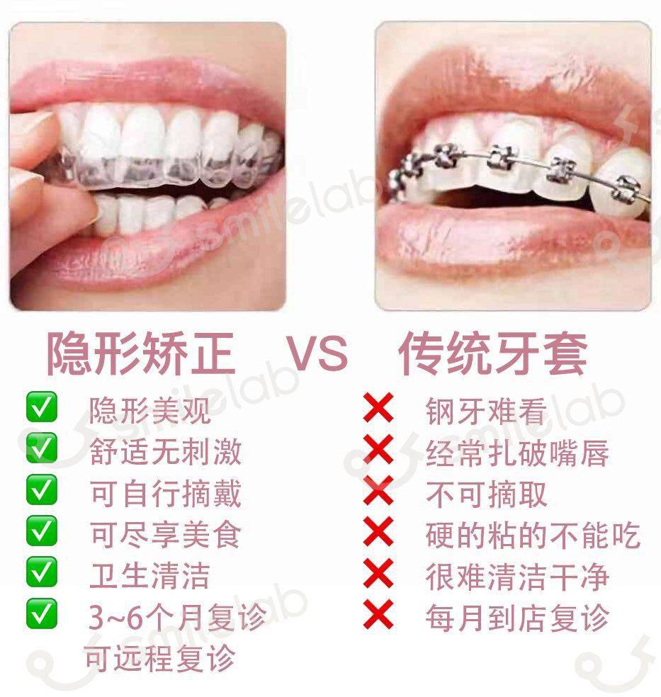 牙齿|“不会吧，不会吧，现在还有没整过牙的明星吧？”