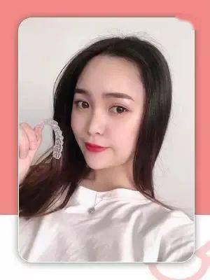 牙齿|“不会吧，不会吧，现在还有没整过牙的明星吧？”