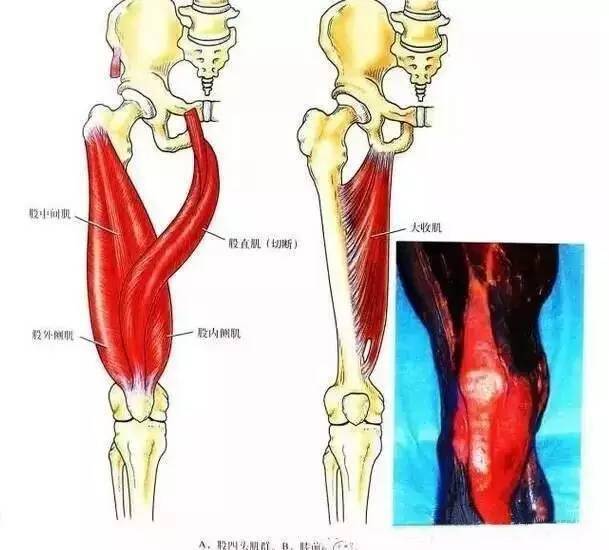 图3:股四头肌(q)角内侧观据marshall报道,膝关节内面的支持结构可分为