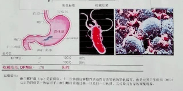 口腔|分手后，女生最难过的事情竟然是......