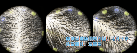 头发|大写的服！热巴居然连一根细小的发丝都不放过...